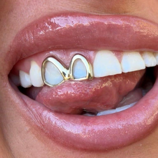 WINDOW TOOTH CAPS