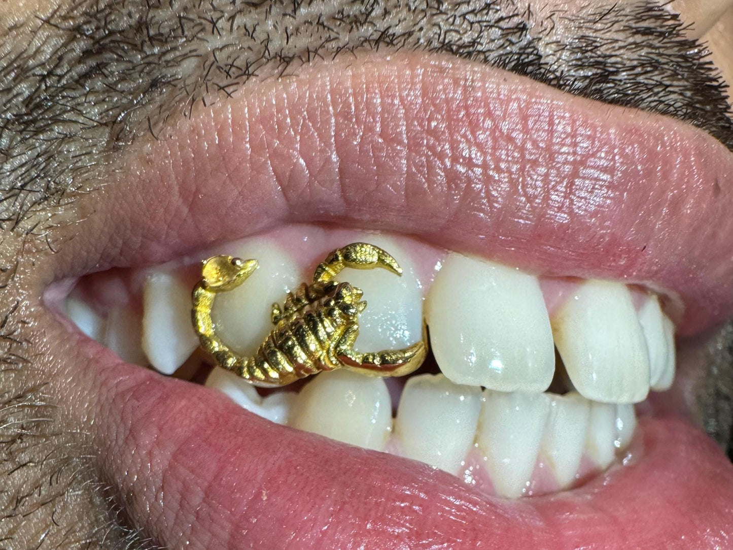 Custom Scorpion Tooth Cap
