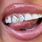 WINDOW TOOTH CAPS