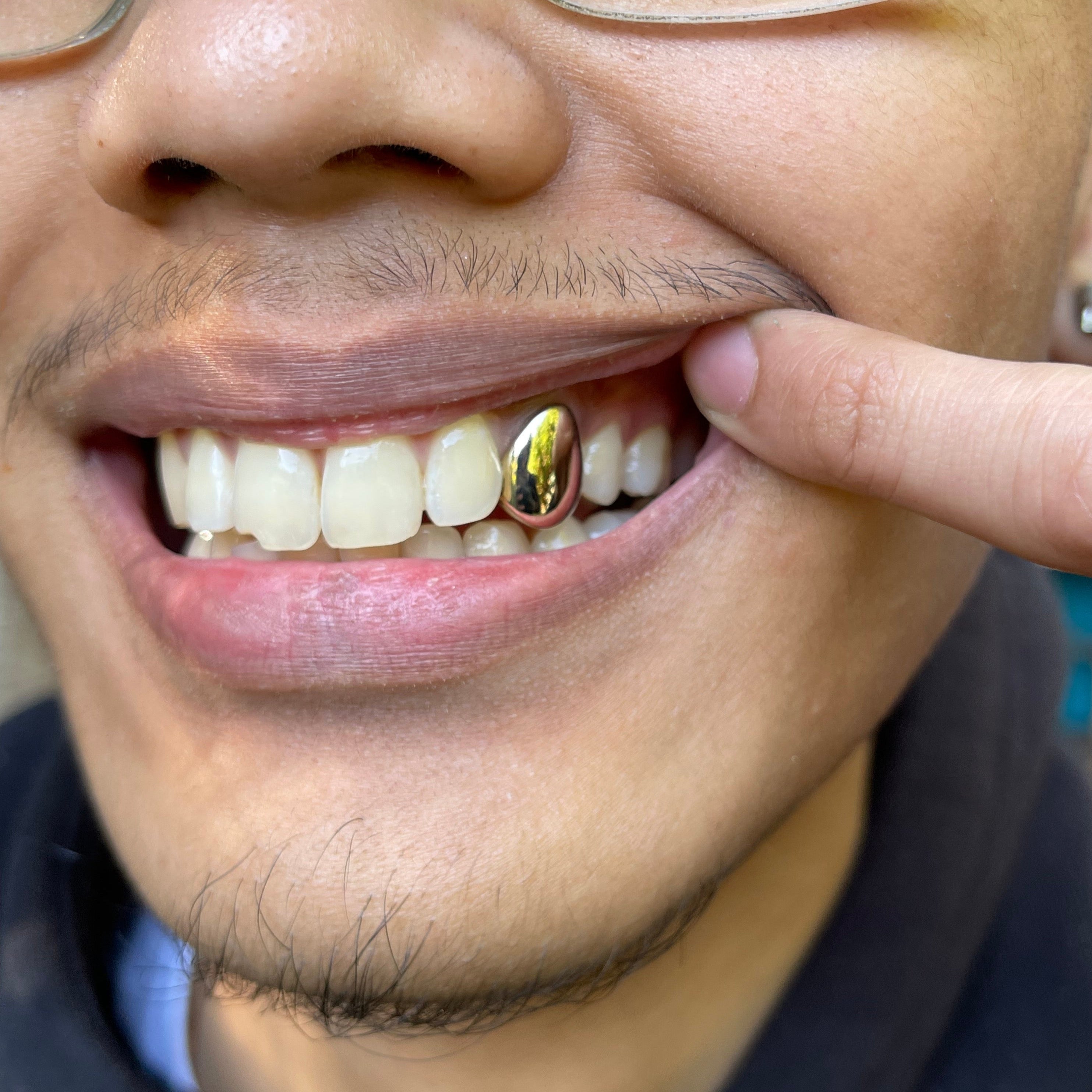 Gold Cap GOLD TOOTH CAPS – GrilledUpUK