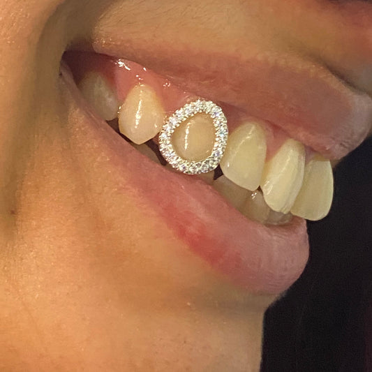 MOISSANITE WINDOW GRILLZ front view